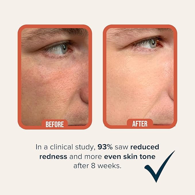 Cardon | Anti-Aging Face Moisturizer for Men | Korean Skincare Facial Lotion | Hydro Boost Gel | Healing Cactus Extract, Reduce Wrinkles, Repair Acne Scars | Ultra Light Face Cream (1 CT)