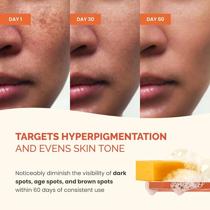 PLANTIFIQUE Kojic Acid Soap for Hyperpigmentation 4 Bars with Mesh Bag - Turmenic Soap with Hyaluronic Acid, Collagen, Vitamin C for Dark Spots - Vegan Skincare, 320g / 11.28 oz (Pack of 2)