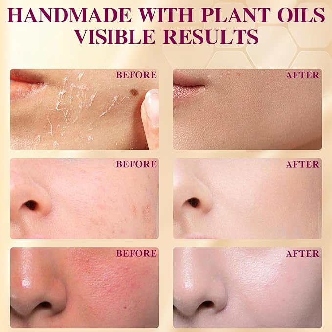 Lavender Grass-Fed Beef Tallow Balm for Men - Whipped Tallow Face Moisturizer & Beard Balm with Manuka Honey - Natural After Shave Care for Dry & Sensitive Skin, 2.1 oz