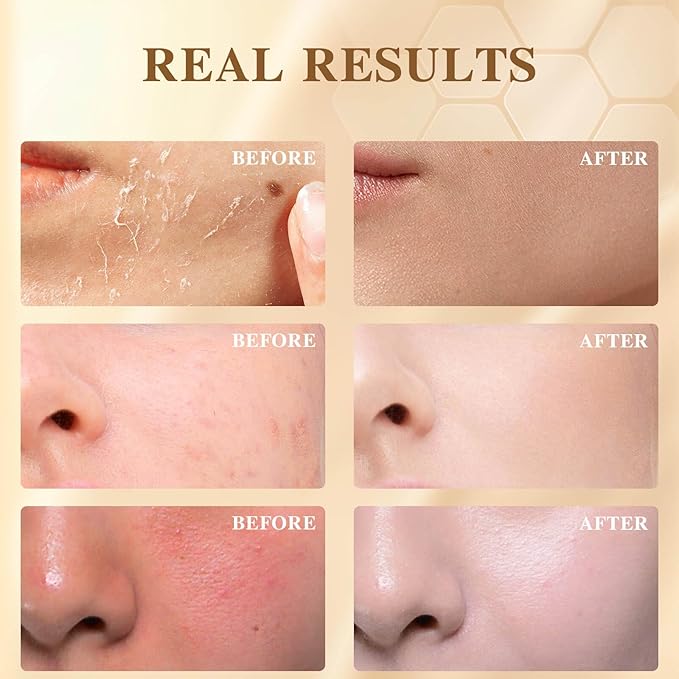 White Tea Grass-Fed Beef Tallow Balm for Men - Whipped Tallow Face Moisturizer & Beard Balm with Manuka Honey - Natural After Shave Care for Dry & Sensitive Skin, 2.1 oz