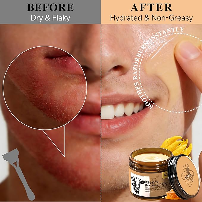 Grass-Fed Beef Tallow Balm for Men - Whipped Tallow Face Moisturizer & Beard Balm with Manuka Honey - Natural After Shave Care for Dry & Sensitive Skin, 2.1 oz