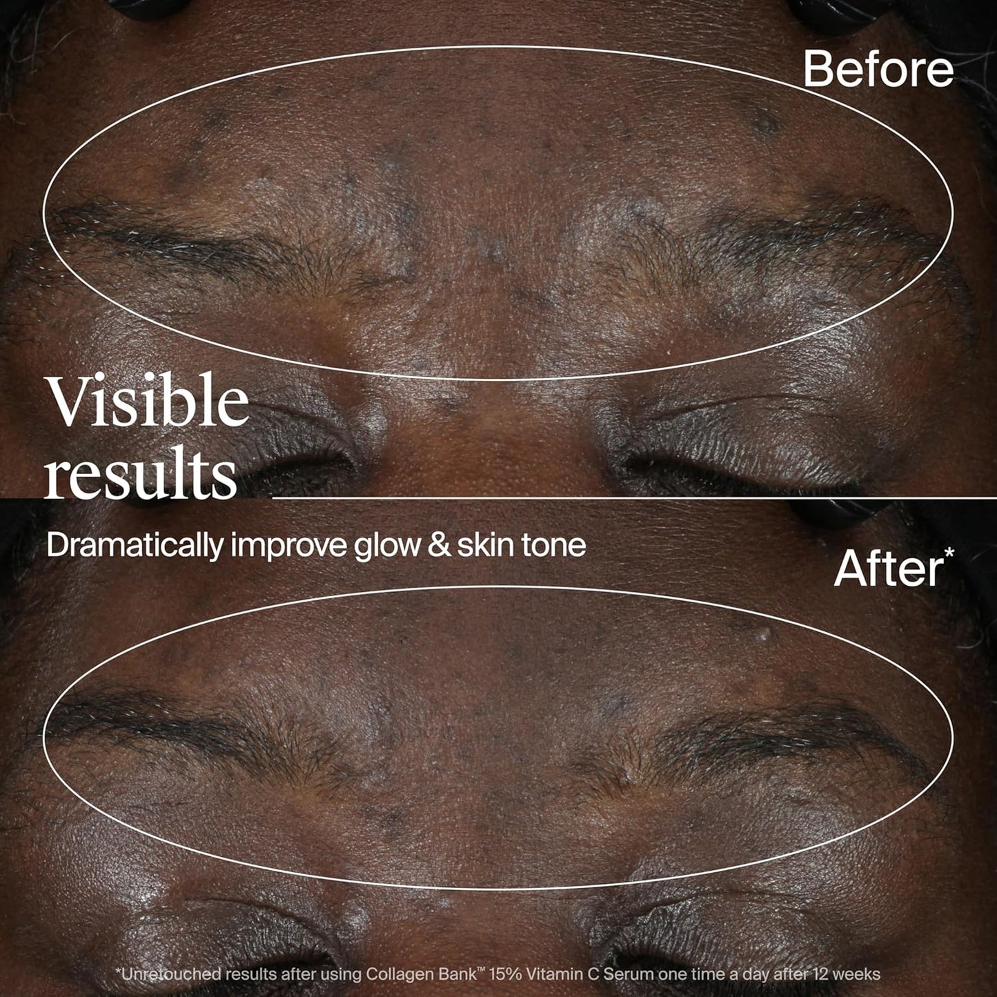 Neutrogena Collagen Bank 15% Vitamin C Face Serum, Vitamin C Serum for Face Helps Build Collagen for Glowing, Plumper Looking Skin, Uneven Skin Tone Treatment, Fragrance Free, 0.5 fl. oz